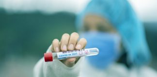 U BiH 629 novozaraženih koronavirusom, preminulo 18 osoba