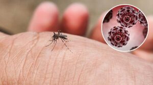 Virus Zapadnog Nila ponovo u fokusu: Kako se zaštititi i kada potražiti pomoć