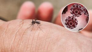 Virus Zapadnog Nila ponovo u fokusu: Kako se zaštititi i kada potražiti pomoć