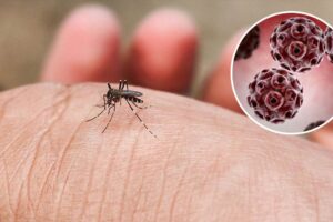 Virus Zapadnog Nila ponovo u fokusu: Kako se zaštititi i kada potražiti pomoć